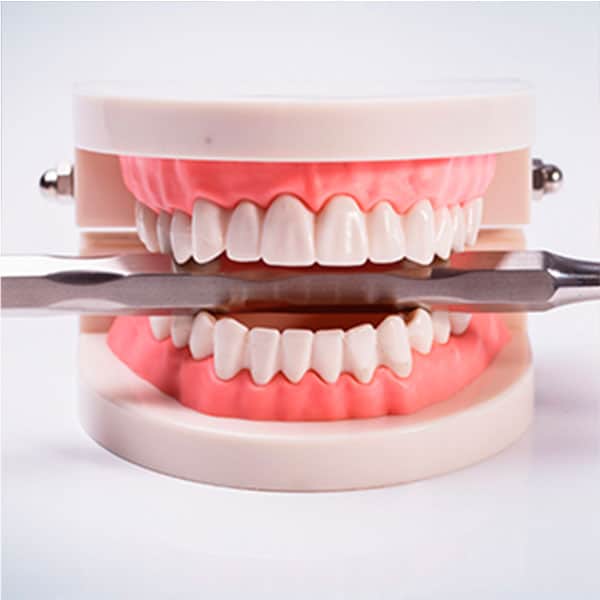 Myobrace, Doutor, disturbios, miofuncional