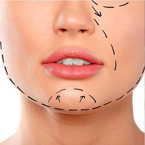 Myobrace, Doutor, disturbios, miofuncional