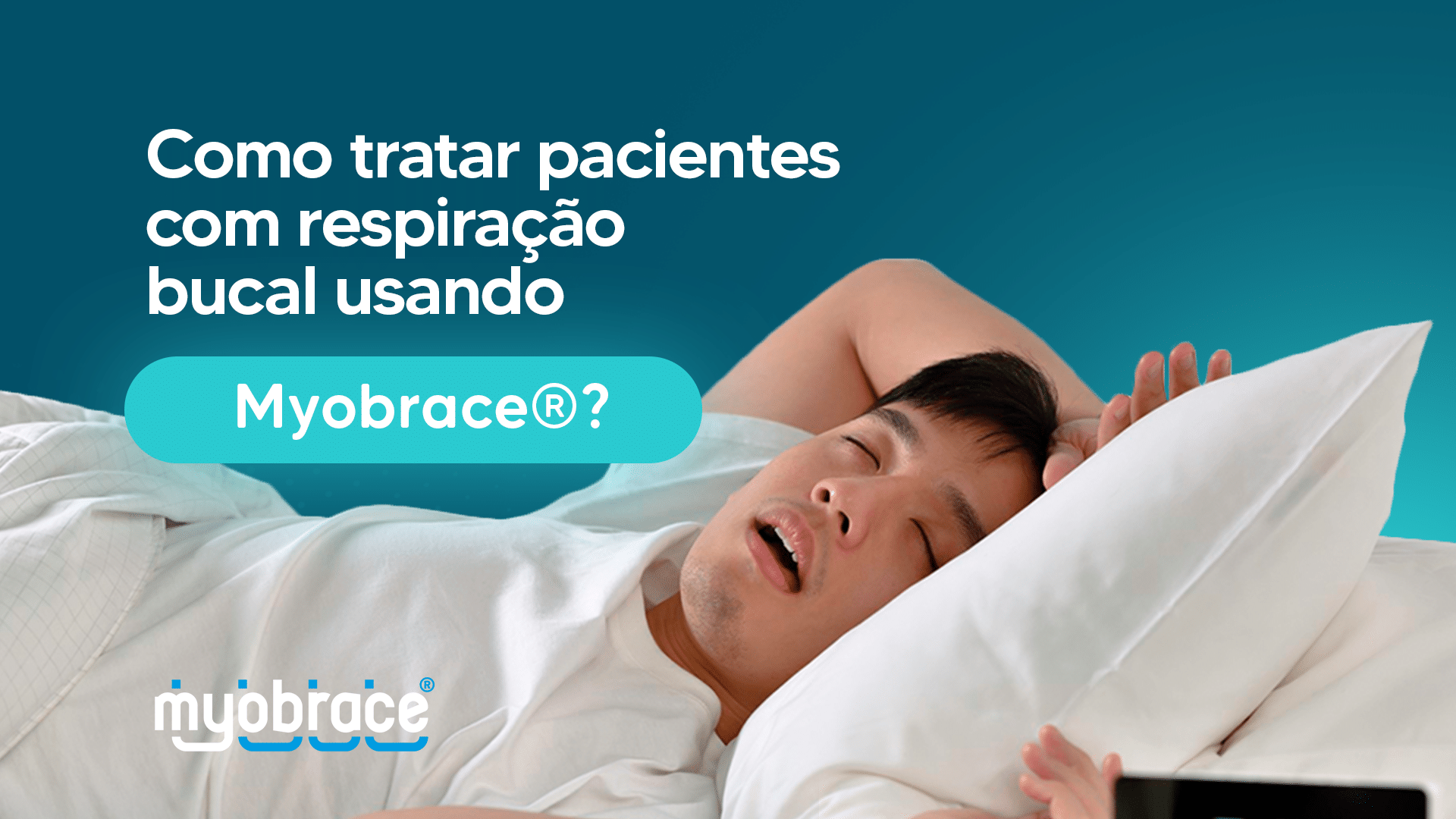 alinhamento dos dentes, alinhar os dentes, como alinhar os dentes, aparelho ortodôntico para alinhamento dos dentes, alinhamento e nivelamento dos dentes, respiração bucal, sistema myobrace, myobrace, odontologia miofuncional, tratar respiração bucal, respiração bucal como tratar, respiração bucal tratamento, como tratar pacientes com respiração bucal, pacientes com respiração bucal, problemas respiração bucal, respirador bucal, como tratar respiração bucal